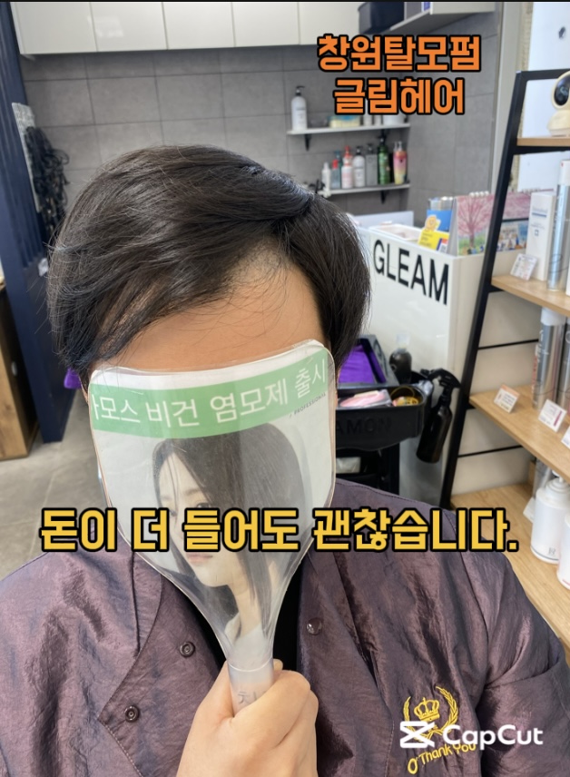 시술 전 — 탈모커버펌